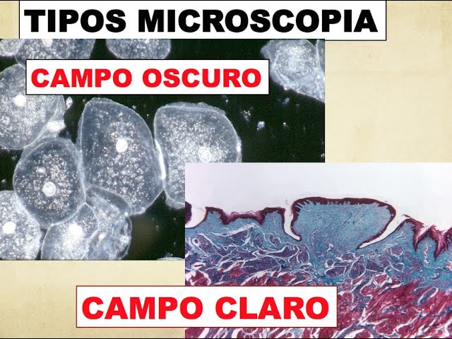 funcionamiento del microscopio de campo oscuro