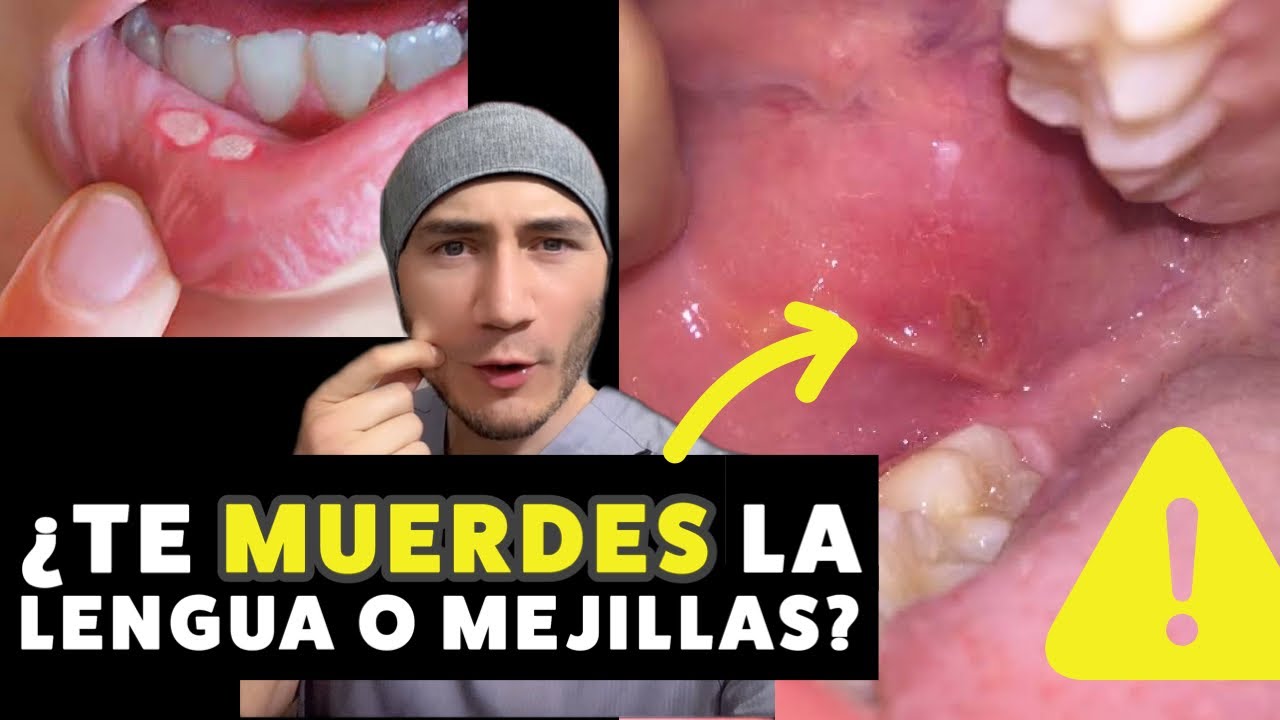 que significa cuando te muerdes el cachete